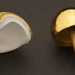 Hip Resurfacing Implants